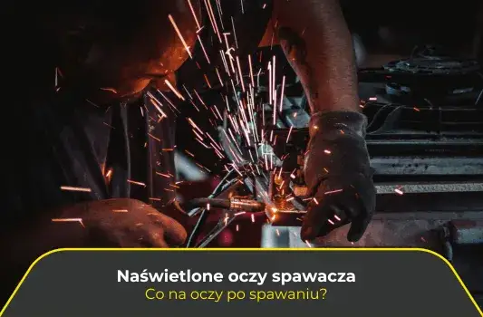 Zdjęcie Naświetlenie oczu spawarką objawy - jak rozpoznać i unikać bólu